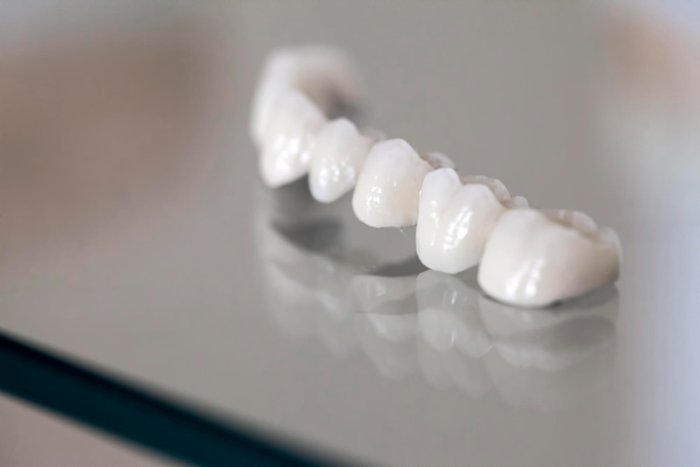 Porcelain Crowns  Upland, CA