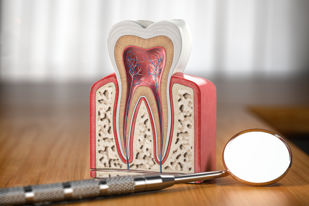 Root Canals Upland, CA