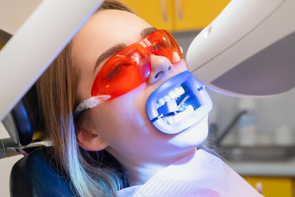 Teeth Whitening Upland, CA
